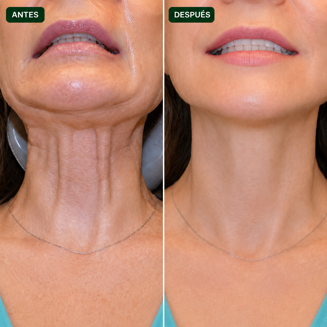 Thyroid Support | El complemento natural para encender tu tiroides desde adentro