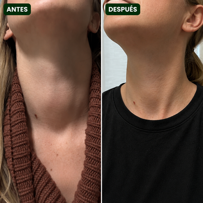 Thyroid Support | El complemento natural para encender tu tiroides desde adentro